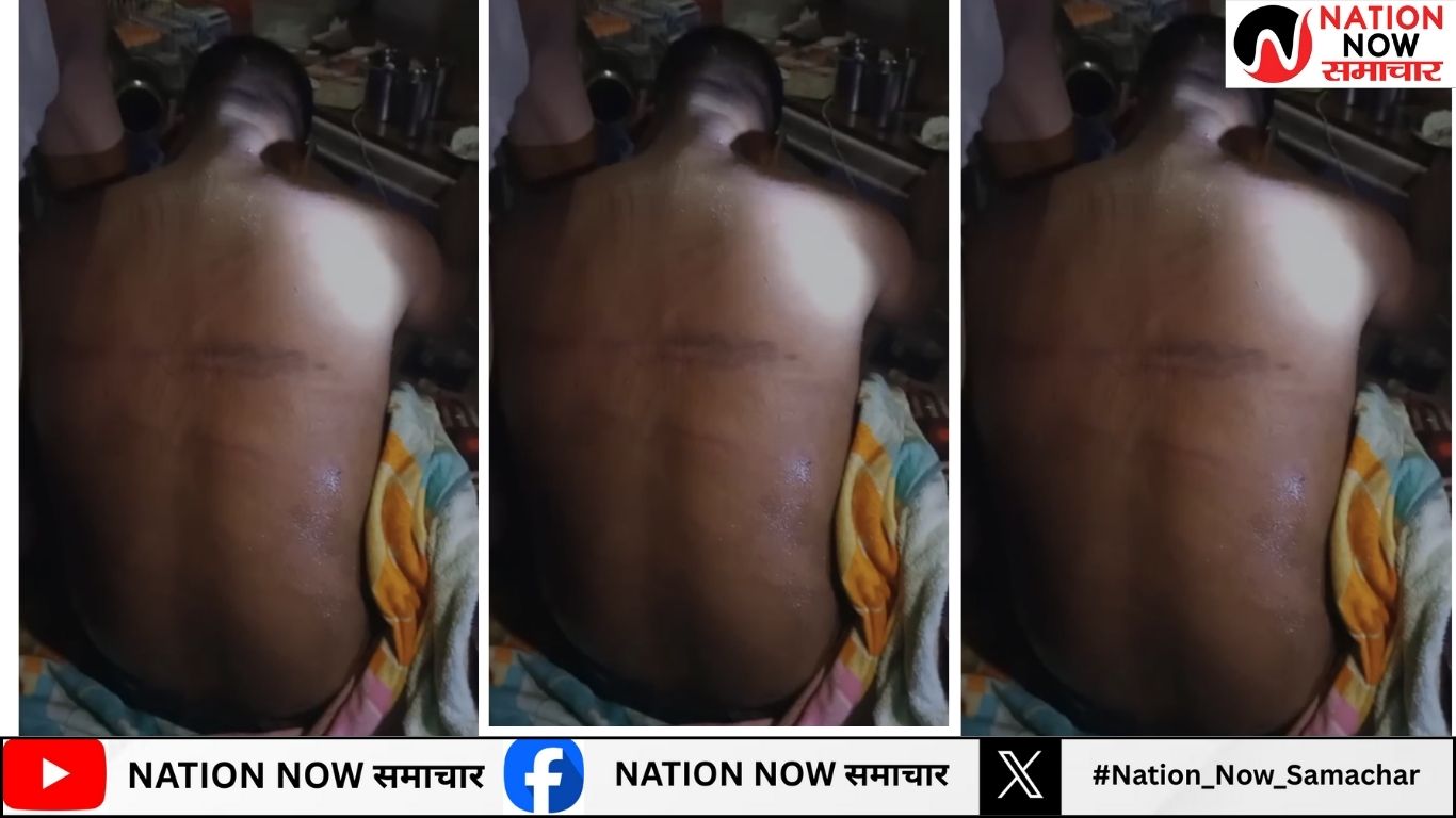 दबंगई का अंजाम कथित भाजपा नेता की पिटाई