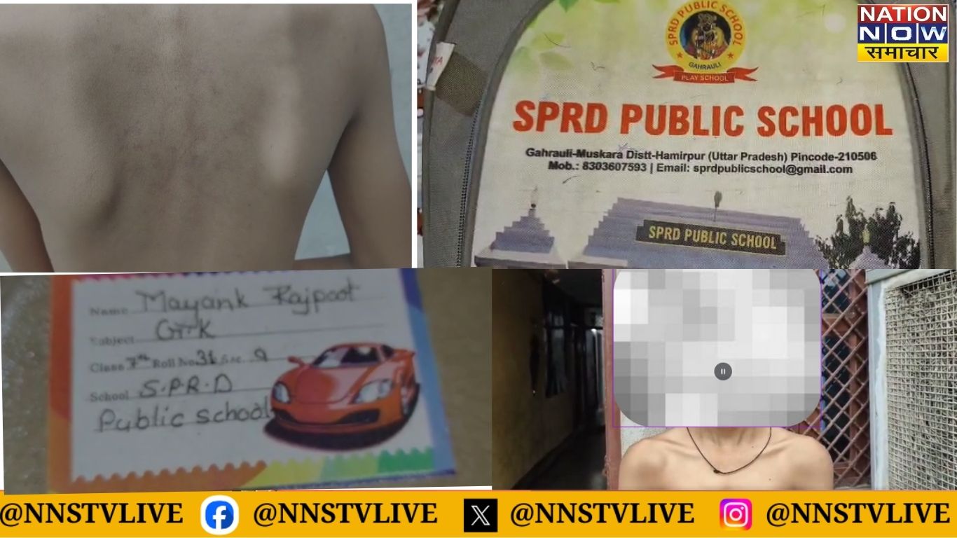 हमीरपुर: कक्षा-7 छात्र की बेरहमी से पिटाई, विद्यालय में बर्बरता