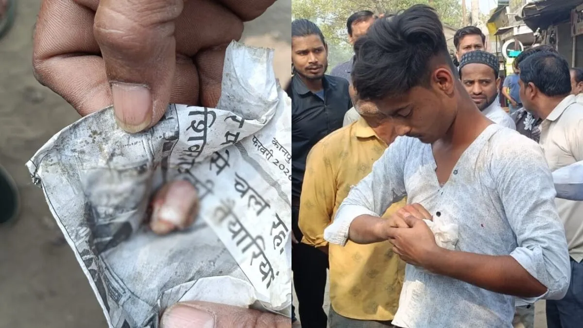 कानपुर: सिगरेट के 7 रुपये मांगने पर हैवानियत... युवक ने दुकानदार की उंगली दांत से काटकर किया अलग
