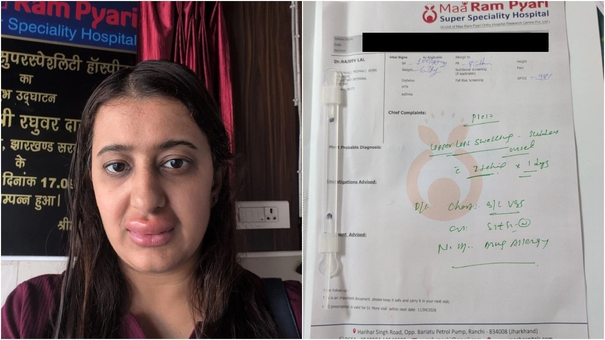 वंदे भारत में परोसा खाना महिला और बेटे के लिए बन गया खतरा, होंठ सूजने और दस्त की शिकायत